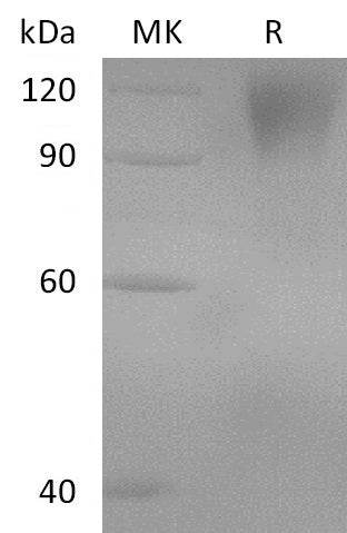 Recombinant Human GUCY2C (C-Fc)