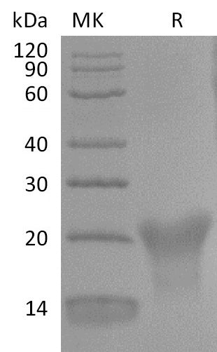 Recombinant Human BAFFR (C-6His)