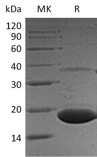 Recombinant Human PPP1R1A (C-6His)