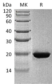 Recombinant Human RBP4