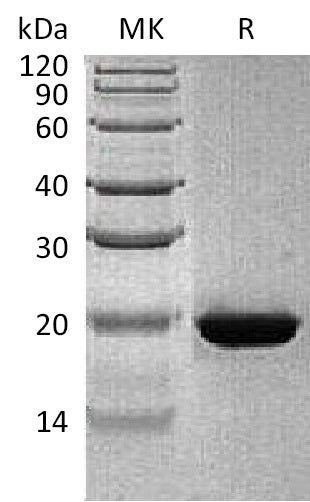 Recombinant Human RBP4