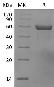 Recombinant Human HLA-A*0201 TP53 complex Protein (C-10His)