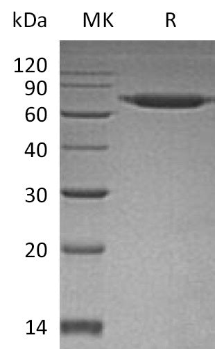 Recombinant Human SENP8 (N-6His)