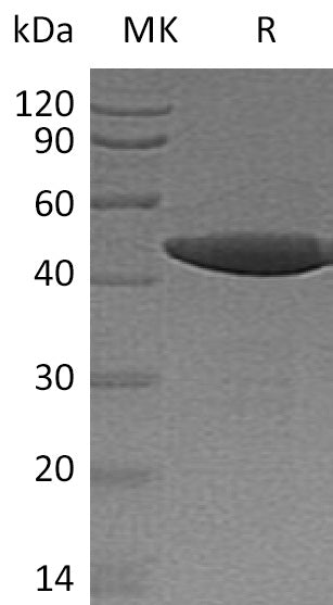 Recombinant Human SENP7