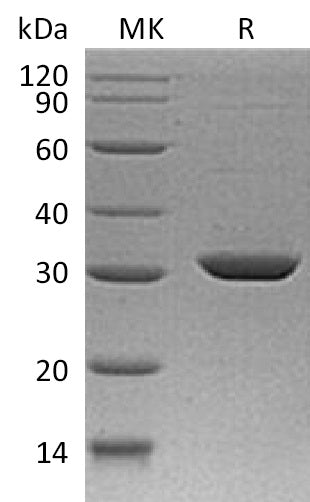 Recombinant Human Stratifin