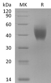 Recombinant Macaca mulatta IL-10RA (C-6His)