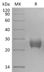 Recombinant Cynomolgus TRAIL R2 (C-6His)