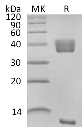 Recombinant Rhesus Macaque Latent TGF-beta 1 (N-6His)