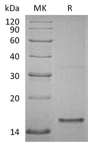 Recombinant Human Tau (624-756aa, C-6His)