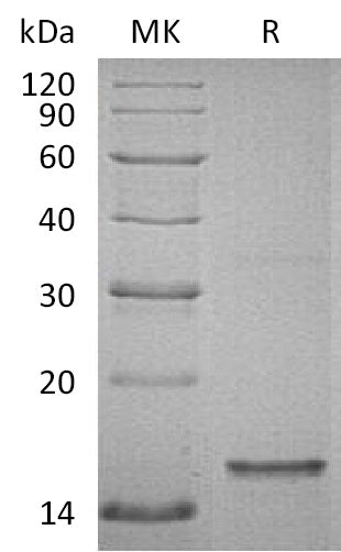 Recombinant Human Tau (624-756aa, C-6His)