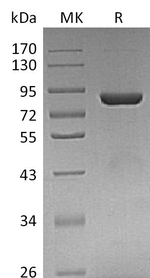Recombinant Human THOP1 (C-6His)