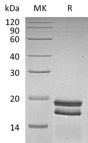 Recombinant Human SUMO1 (N-6His)