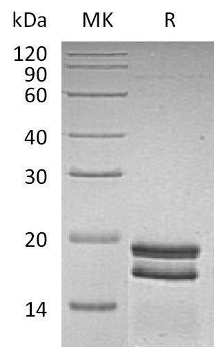 Recombinant Human SUMO1 (N-6His)