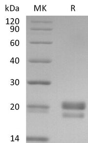 Recombinant Human CD40L (N-6His-Flag)