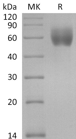 Recombinant Human IL18R1 (C-6His)