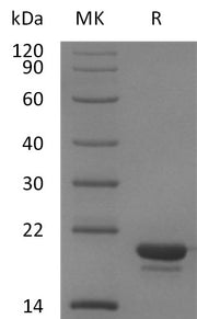 Recombinant Human Stathmin (C-6His)