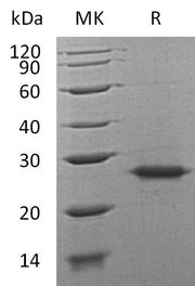 Recombinant Human Grancalcin