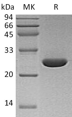 Recombinant Human UCH-L3 (C-6His)