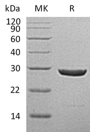 Recombinant Human UCH-L1 (C-6His)