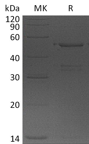 Recombinant Human USP14 (N-6His)