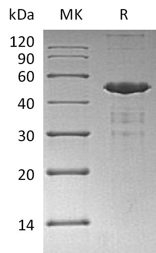 Recombinant Human UBE2A (N-GST, 6His)