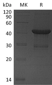 Recombinant Human UBE2D4 (N-GST)