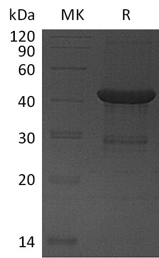 Recombinant Human UBE2D4 (N-GST)