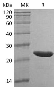 Recombinant Human TMPO (C-6His)