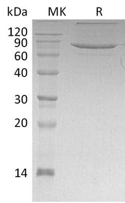 Recombinant Human XPNPEP1 (C-6His)