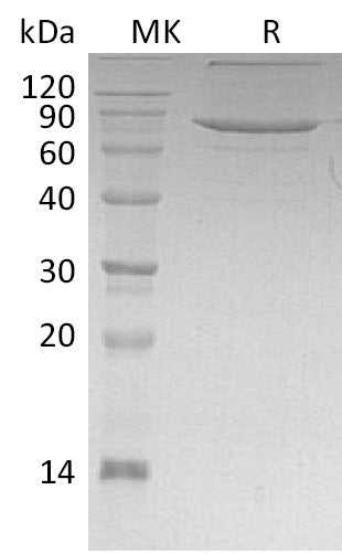 Recombinant Human XPNPEP1 (C-6His)