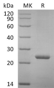 Recombinant Mouse PRL (C-6His)