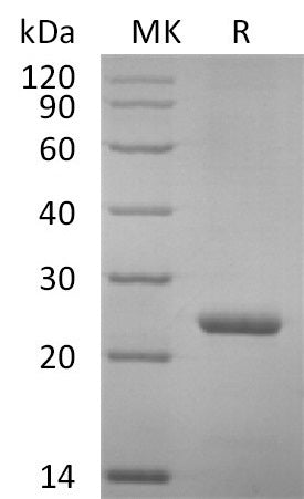 Recombinant Mouse PRL (C-6His)