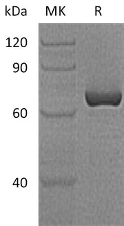 Recombinant Human Serpin A12 (N-GST)