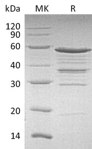 Recombinant Human NOL3 (N-GST)