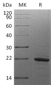 Recombinant Human MAX (C-6His)