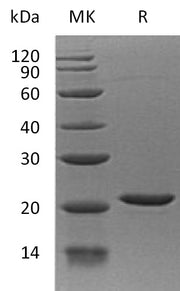 Recombinant Human EIF1AX (N-6His)