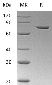 Recombinant Human ANXA6 (C-6His)