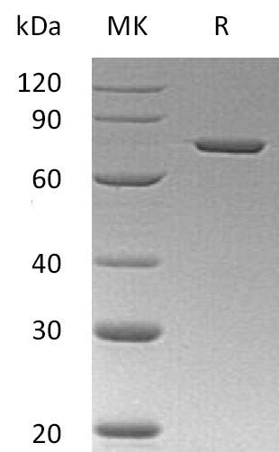 Recombinant Human ANXA6 (C-6His)