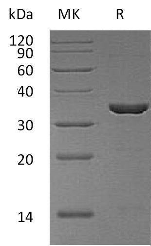 Recombinant Human PPIE (N-6His)