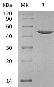 Recombinant Human ANXA7