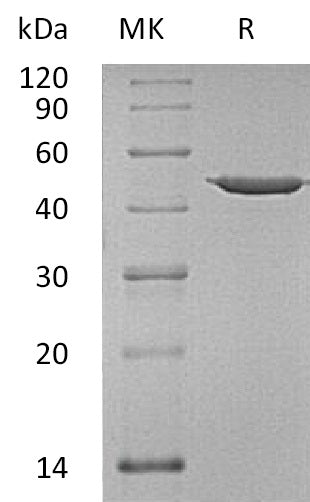 Recombinant Human ANXA7