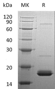 Recombinant Human CYB5A (N-6His)