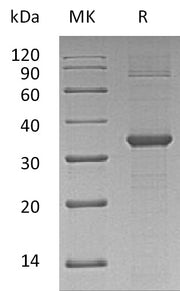 Recombinant Human CDK2 (N-6His)