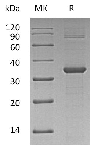 Recombinant Human CDK2 (N-6His)