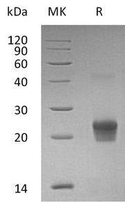 Recombinant Human GGCT (N-6His)