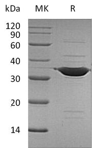 Recombinant Human ANXA5