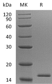 Recombinant Human EIF1B (N-6His)