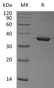 Recombinant Human ANXA2
