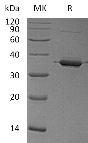 Recombinant Human ANXA2