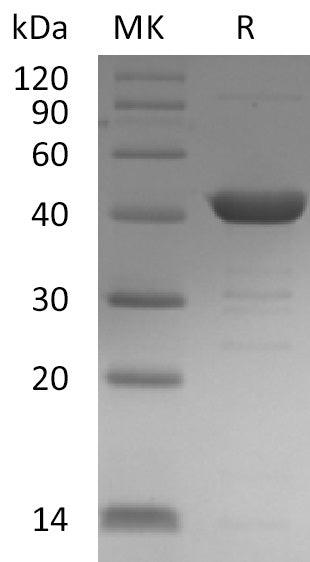 Recombinant Human UPB1 (C-6His)